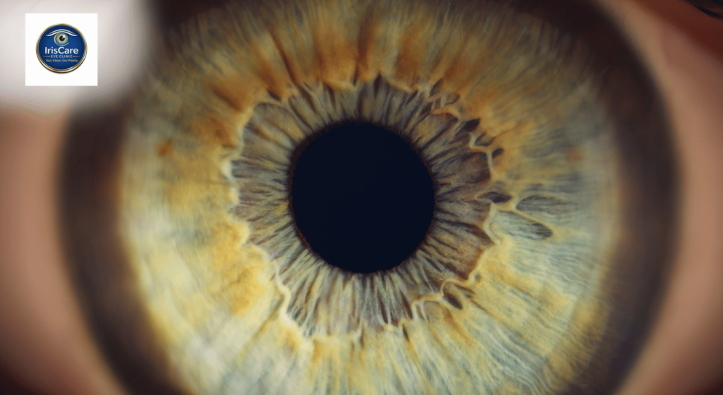 Happy Healthy Vision Month: Why May is the Most Important Month for Your Eyes May Iris 1024x559